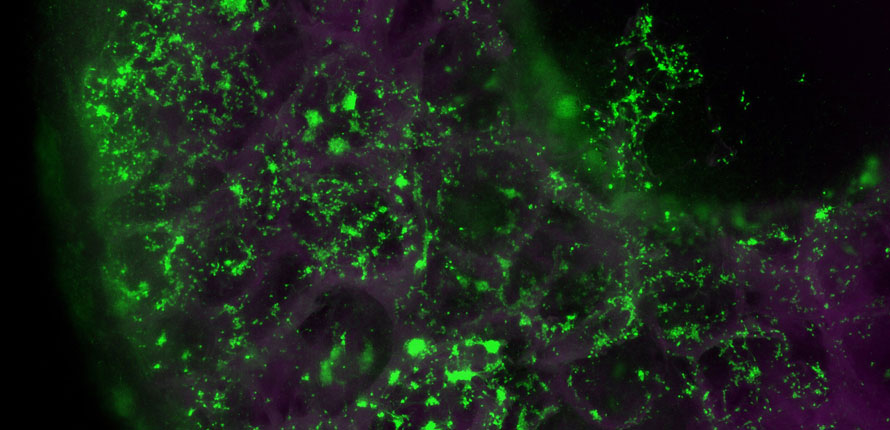 brain scaffold